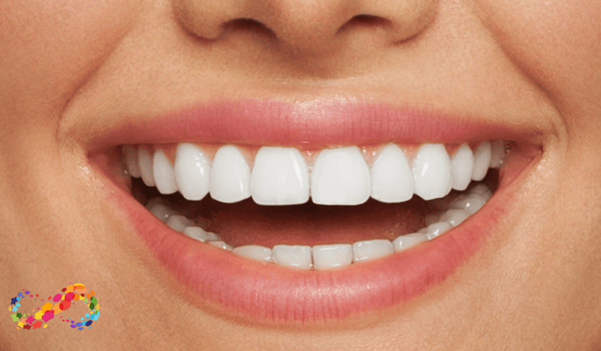 White Stains on Teeth